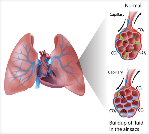 pulmonary sac